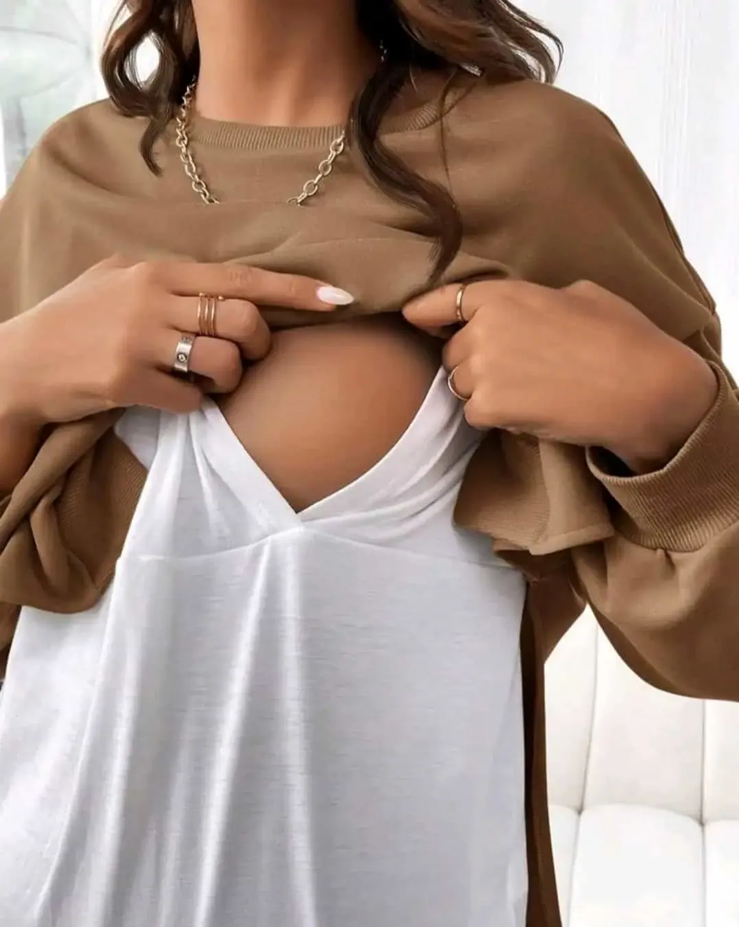 Conjunto Canel, foto 2
